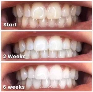 Whitening toothpaste